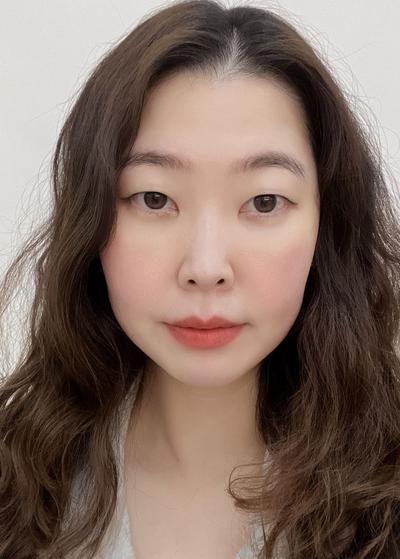 눈밑꺼짐 수술 6주차, 화장으로 못 가리던 그늘 없어졌어요 사진 4 — 아바성형외과 눈밑지방재배치 후기