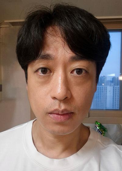 눈밑지방재배치 눈매교정 2주차, 통증도 없고 피곤한 인상 사라졌어요 사진 2 — 아바성형외과 눈밑지방재배치 후기