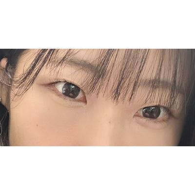 눈성형 환자 후기 — 브라운성형외과에서 김승수 원... (336)