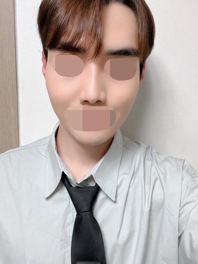 본문 없이 안내 문구만 남겨진 후기입니다 사진 5 — 아바성형외과 기타 후기
