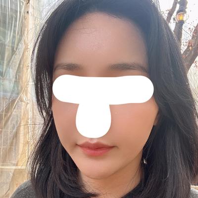 지방이식 환자 후기 — 지방후기 6주차 입니다.
첫... (34)