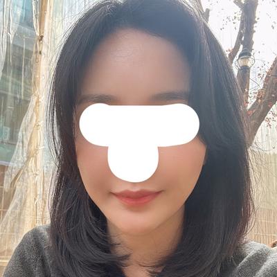 지방이식 6주차, 첫 지방이식인데 생착률 좋아서 대만족이에요 사진 4 — 아바성형외과 지방이식 후기