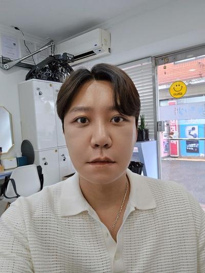 안면거상 3주차, 깊던 팔자주름과 처진 심부볼 잡았어요 — 아바성형외과 환자 후기 사진
