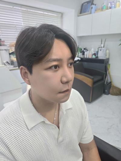 안면거상 3주차, 깊던 팔자주름과 처진 심부볼 잡았어요 사진 4 — 아바성형외과 안면거상 후기