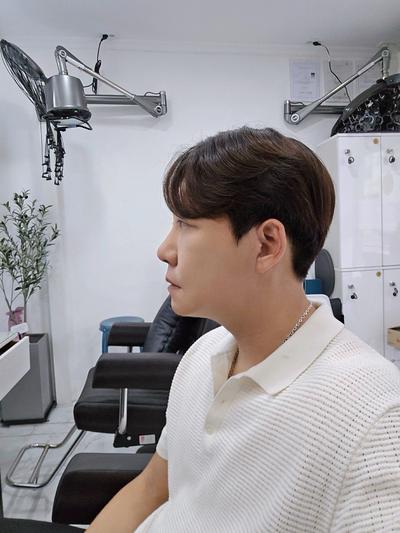 안면거상 3주차, 깊던 팔자주름과 처진 심부볼 잡았어요 사진 5 — 아바성형외과 안면거상 후기