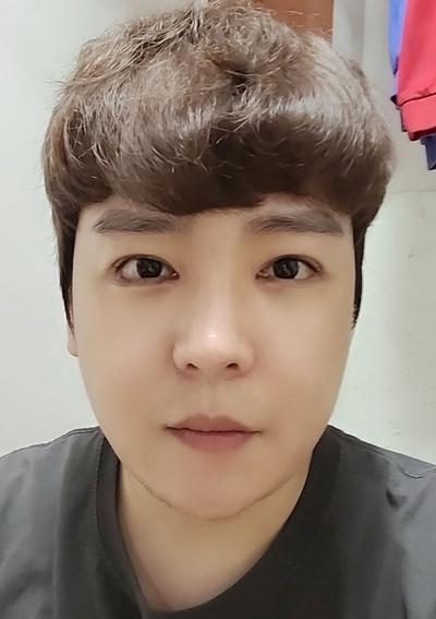 뒤트임 상담 갔다 몽고주름까지, 주변에서 잘됐다고 해요 — 아바성형외과 환자 후기 사진