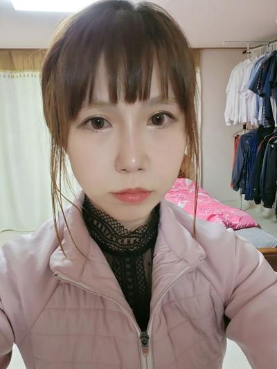 코성형 4개월차, 콧대랑 코끝 모양 너무 마음에 들어요 — 아바성형외과 환자 후기 사진
