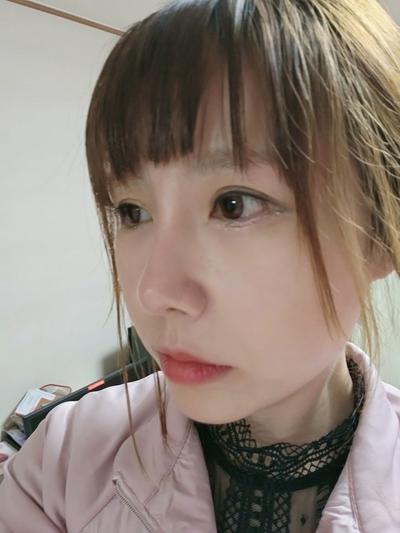 코성형 4개월차, 콧대랑 코끝 모양 너무 마음에 들어요 사진 5 — 아바성형외과 코성형 후기