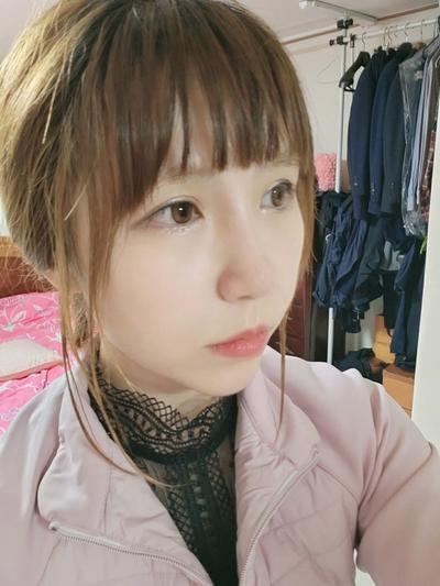 코성형 4개월차, 콧대랑 코끝 모양 너무 마음에 들어요 사진 6 — 아바성형외과 코성형 후기