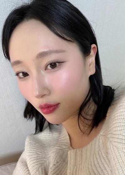눈밑지방재배치 4주차, 인상 부드러워졌다는 말 많이 들어요 사진 4 — 아바성형외과 눈밑지방재배치 후기