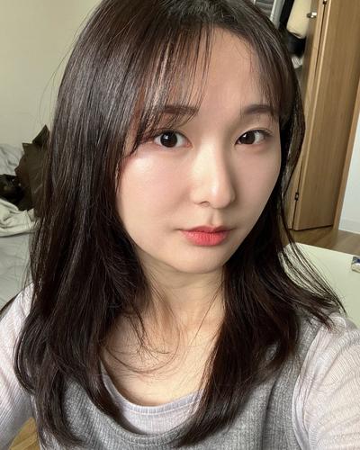 눈밑지방재배치 한 달, 짝짝이 굴곡 정리되고 눈가가 환해졌어요 — 아바성형외과 환자 후기 사진