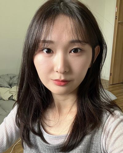 눈밑지방재배치 한 달, 짝짝이 굴곡 정리되고 눈가가 환해졌어요 사진 4 — 아바성형외과 눈밑지방재배치 후기