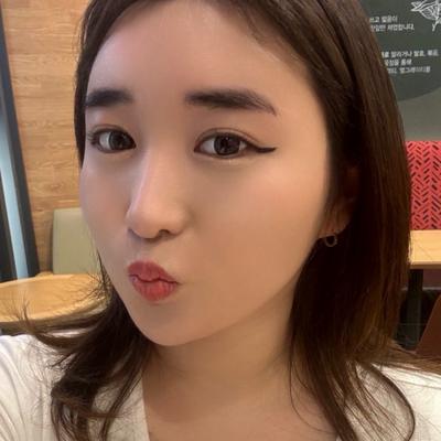 이마 관자놀이 지방이식, 볼륨감 자연스럽게 생겨 만족해요 사진 4 — 아바성형외과 이마거상 후기