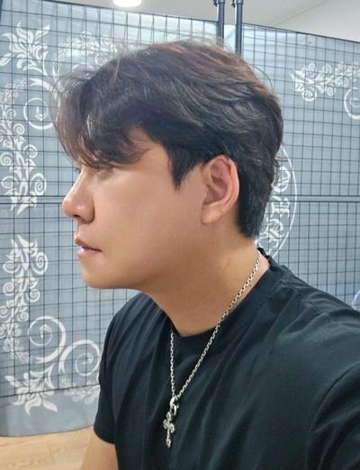 수술 7주차, 붓기 많이 빠지고 흉터 연고 열심히 바르는 중 — 아바성형외과 환자 후기 사진