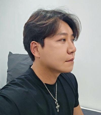 수술 7주차, 붓기 많이 빠지고 흉터 연고 열심히 바르는 중 사진 4 — 아바성형외과 기타 후기