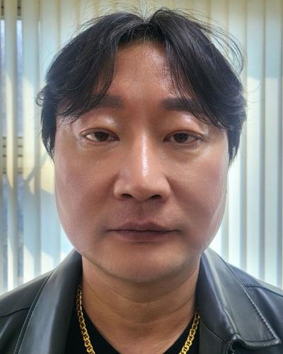 상안검 6주차, 시야 편해지고 수술한 줄 모를 만큼 자연스러워요 — 아바성형외과 환자 후기 사진