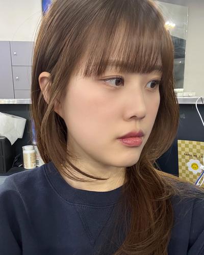 눈밑지방재배치 10주차, 짝짝이 애교살 밸런스까지 만족 사진 5 — 아바성형외과 눈밑지방재배치 후기