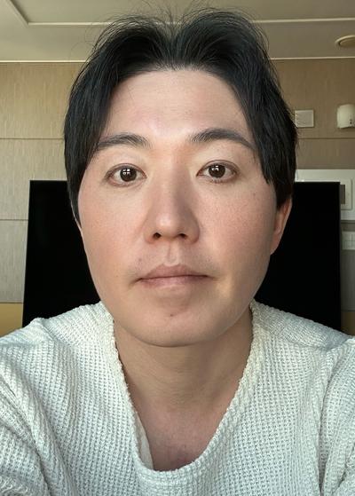 수술 4주차, 어디서 했냐고 지인들이 계속 물어봐요 — 아바성형외과 환자 후기 사진