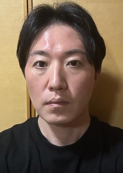 수술 4주차, 어디서 했냐고 지인들이 계속 물어봐요 사진 2 — 아바성형외과 안면거상 후기