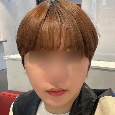 안면거상 환자 후기 — 브라운성형외과 김승수 원장님... (389)