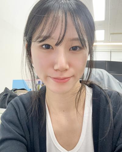 수술 4주차, 안색 밝아지고 그림자도 안 져요 진작 할 걸 — 아바성형외과 환자 후기 사진
