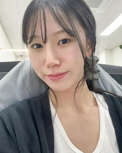 수술 4주차, 안색 밝아지고 그림자도 안 져요 진작 할 걸 사진 4 — 아바성형외과 기타 후기