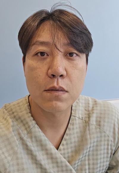 수술 9주차 후기, 신경 감각도 90프로 회복됐어요 사진 2 — 아바성형외과 기타 후기
