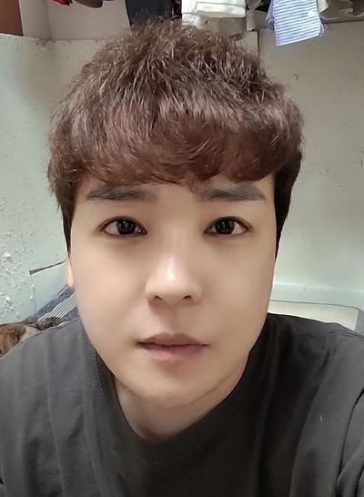 5주차 후기, 붓기 빠지고 자리 잡혀서 기대가 커요 — 아바성형외과 환자 후기 사진