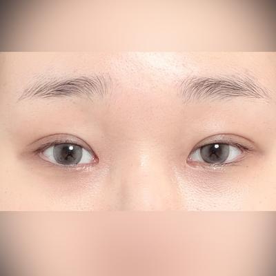 바비톡 통신판매 책임 관련 안내 문구만 있는 후기예요 — 아바성형외과 환자 후기 사진