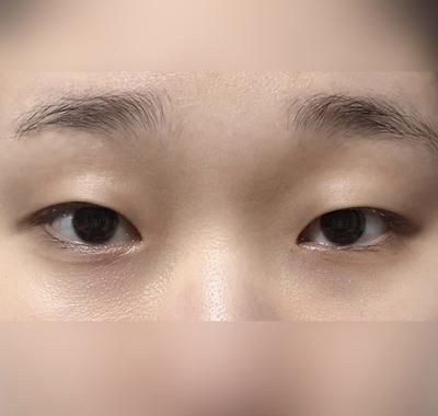 바비톡 통신판매 책임 관련 안내 문구만 있는 후기예요 사진 2 — 아바성형외과 기타 후기