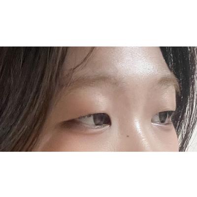 절개 쌍꺼풀 6주차, 눈 또렷해졌다는 말 자주 들어요 사진 2 — 아바성형외과 쌍꺼풀·눈성형 후기