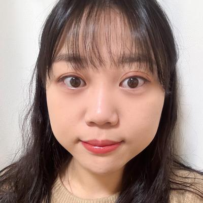 시술 10주차, 수술했었나 싶을 정도로 자연스러워요 — 아바성형외과 환자 후기 사진