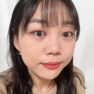 시술 10주차, 수술했었나 싶을 정도로 자연스러워요 사진 4 — 아바성형외과 쌍꺼풀·눈성형 후기