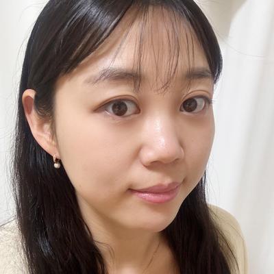 눈밑지방재배치 8주차, 다크서클 고민 덜어서 하길 잘했어요 — 아바성형외과 환자 후기 사진