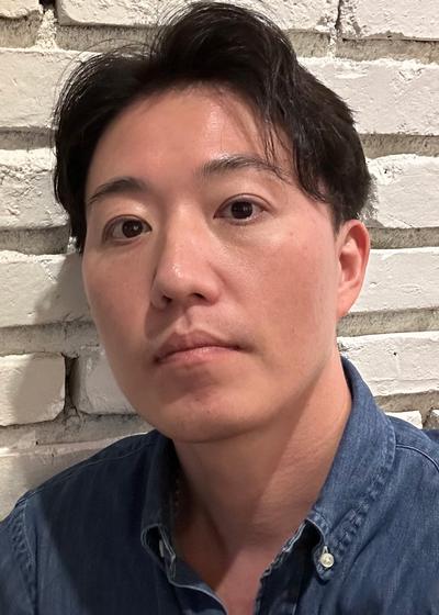 시술 2주차, 수술한지 모를 정도로 회복 빨라서 편했어요 사진 3 — 아바성형외과 기타 후기