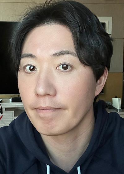 시술 2주차, 수술한지 모를 정도로 회복 빨라서 편했어요 사진 4 — 아바성형외과 기타 후기