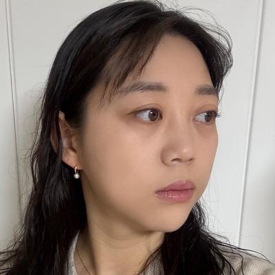 눈밑지방재배치 2주차, 자연스러운 애굣살 생긴 느낌이에요 사진 2 — 아바성형외과 눈밑지방재배치 후기