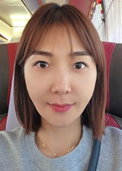 눈밑지방재배치 후 어려보인다는 말 많이 들어서 완전 만족 — 아바성형외과 환자 후기 사진