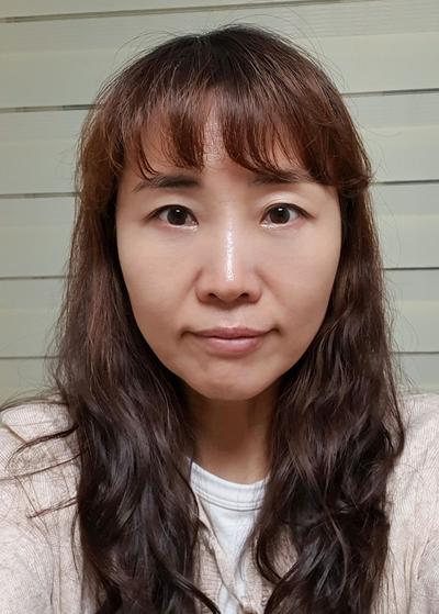 수술 6주차, 광대 잔통증 가끔 있지만 비교적 괜찮아요 — 아바성형외과 환자 후기 사진