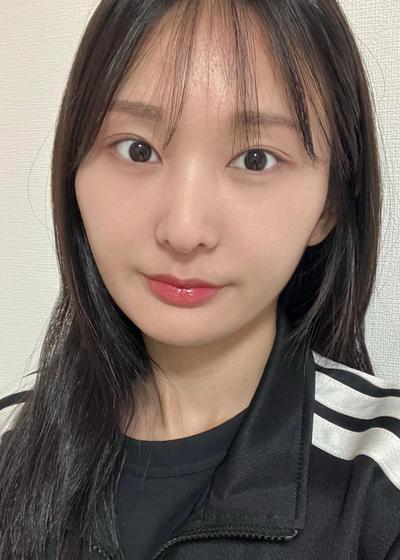 눈밑지방재배치 후 화장 안 해도 다크서클 안 보여요 — 아바성형외과 환자 후기 사진