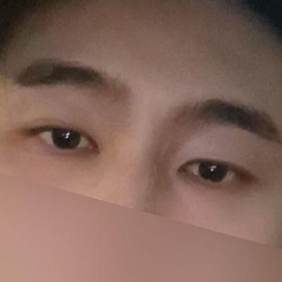 수술 한 달차, 회복 빠르고 지금 굉장히 만족스러워요 사진 2 — 아바성형외과 기타 후기