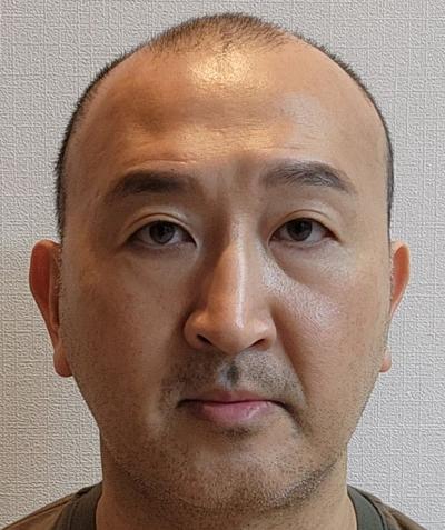 눈밑지방재배치 7주차, 피곤해보인다는 소리 이제 안 들어요 사진 3 — 아바성형외과 눈밑지방재배치 후기