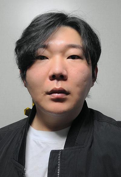 수술 12주차, 걱정 많았는데 지금 보니 참 잘했다 싶어요 사진 2 — 아바성형외과 기타 후기