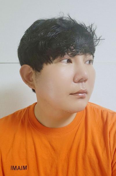 수술 12주차, 걱정 많았는데 지금 보니 참 잘했다 싶어요 사진 5 — 아바성형외과 기타 후기