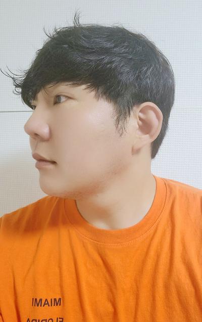 수술 12주차, 걱정 많았는데 지금 보니 참 잘했다 싶어요 사진 6 — 아바성형외과 기타 후기