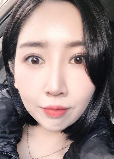 매몰＋자연유착＋윗트임 8주차, 인라인 예쁘게 잡혀 대만족 — 아바성형외과 환자 후기 사진