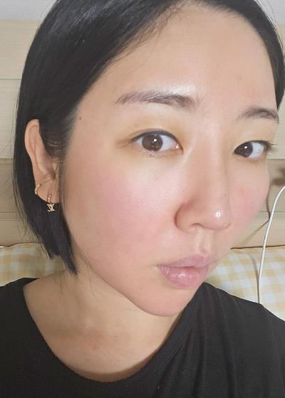 매몰＋자연유착＋윗트임 8주차, 인라인 예쁘게 잡혀 대만족 사진 3 — 아바성형외과 쌍꺼풀·눈성형 후기