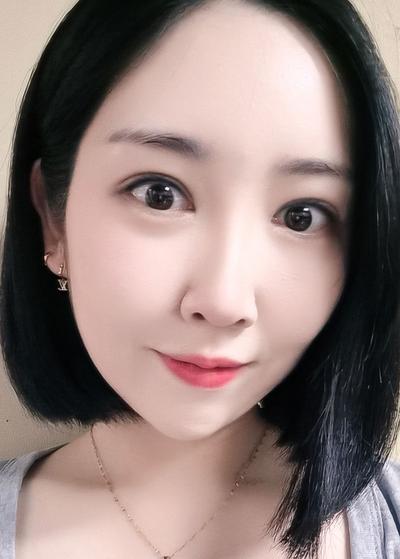 매몰＋자연유착＋윗트임 8주차, 인라인 예쁘게 잡혀 대만족 사진 4 — 아바성형외과 쌍꺼풀·눈성형 후기