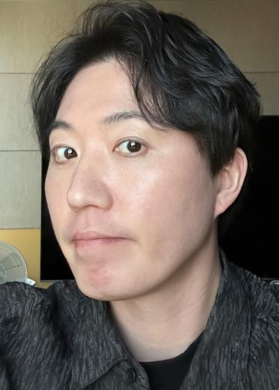 눈밑지방재배치 8주차, 수술한 걸 잊을 만큼 자연스러워요 — 아바성형외과 환자 후기 사진