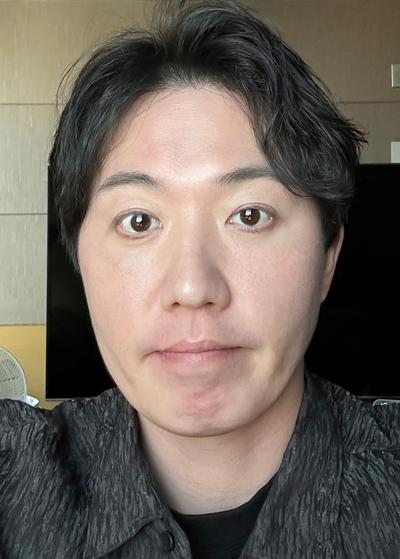 눈밑지방재배치 8주차, 수술한 걸 잊을 만큼 자연스러워요 사진 4 — 아바성형외과 눈밑지방재배치 후기
